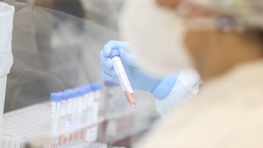 Covid: Paraná confirma primeiro caso da variante indiana no estado